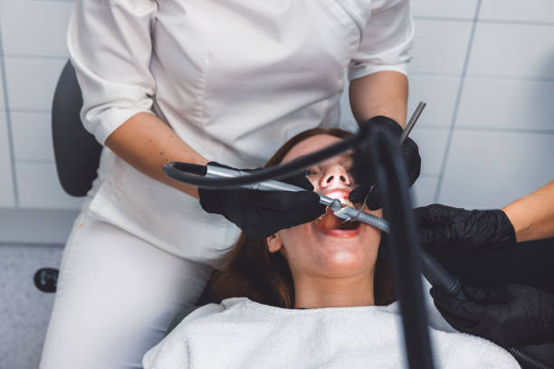 Best Knocked-Out Tooth (Avulsed Tooth) Treatment in Richmond, CA