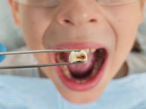 Best Emergency Treatment for Jaw Pain or Injury in Richmond, CA