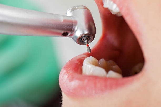  Richmond, CA Emergency Dentist Pros